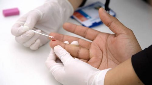 El ajuste a los pacientes de VIH llegó a los controles de transmisión