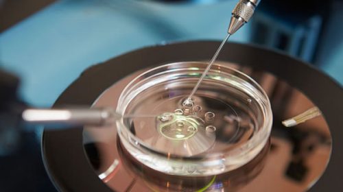 La Justicia autorizó a desechar los embriones congelados de una pareja que no quiere tener más hijos