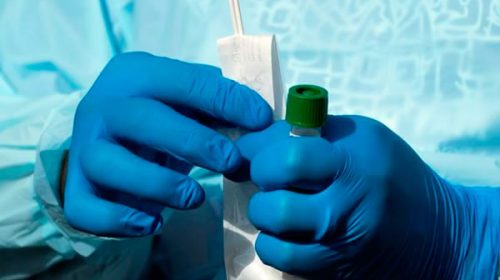 Coronavirus: realizan 50 pruebas diarias en laboratorio de la región de Salto Grande Coronavirus: realizan 50 pruebas diarias en laboratorio de la región de Salto Grande