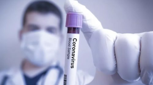 Se registraron siete nuevos casos de coronavirus