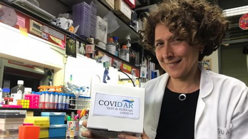 Coronavirus: el primer test serológico hecho en la Argentina