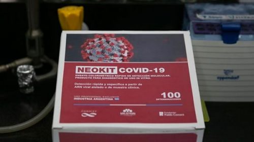 Cómo funciona NEOKIT-COVID-19, el test rápido para detectar el coronavirus