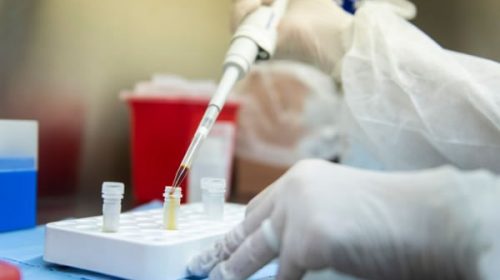 Llegó al país el kit que necesitan todas las empresas para volver al negocio: dice en tiempo real si hay algo infectado