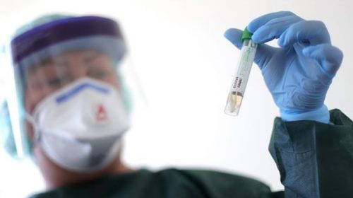 Realizaron hisopados a tres personas con síntomas y nexo epidemiológico en Chajarí