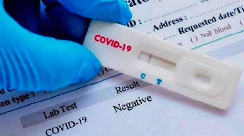 Este lunes en Entre Ríos se registraron 18 nuevos casos de coronavirus