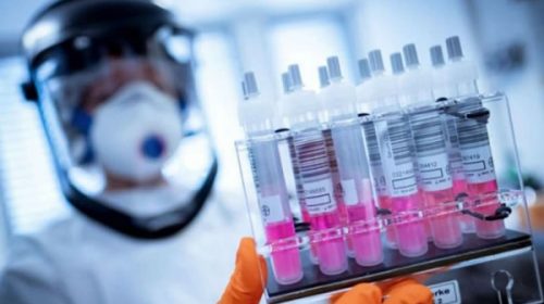 Empiezan a probar la vacuna contra el coronavirus en Argentina