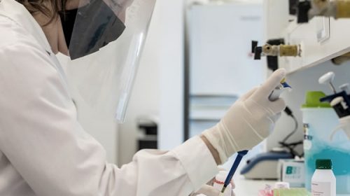Investigadores de la Universidad del Litoral estudian detección de anticuerpos contra el coronavirus