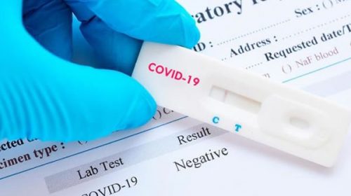 Piden el test de diagnóstico rápido para los trabajadores de Salud