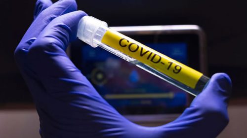 Confirman 22 nuevos casos de Covid en Chajarí y 6 en Villa del Rosario