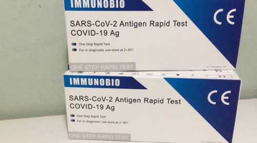 Test rápido de antígeno: se vende en farmacias y detecta el coronavirus en 10 minutos