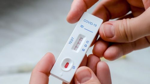 Algunas farmacias de Entre Ríos ya tienen autotest de coronavirus en venta
