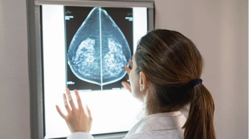 Más de 130 mil casos de cáncer se diagnostican por año en Argentina