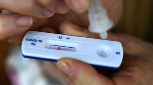 En casi un mes, ya se vendieron más de 19 mil autotest de coronavirus en farmacias