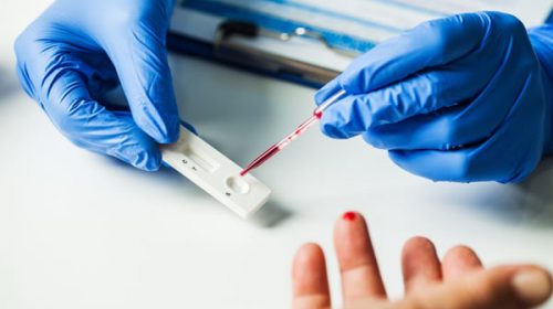 Chaco producirá los primeros test serológicos del país para detectar anticuerpos de coronavirus