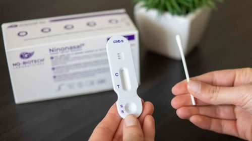 La ANMAT autorizó un nuevo autotest de coronavirus que da resultados en 15 minutos