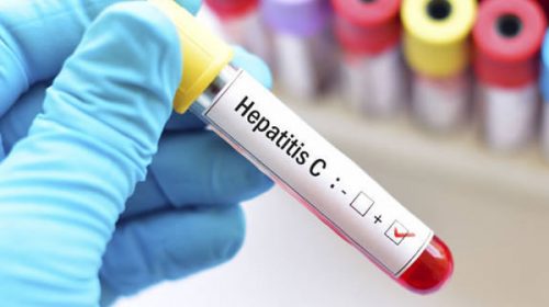 La ANMAT aprobó una prueba rápida para la detección del virus de la hepatitis C