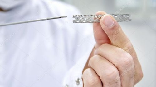 La Anmat prohibió la venta de un sistema de stent periférico