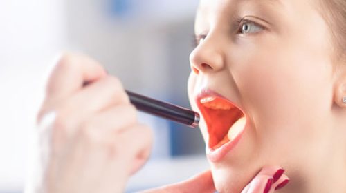 Salud emitió recomendaciones ante la bacteria Streptococcus pyogenes