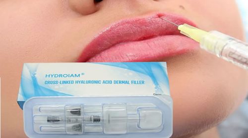 ANMAT prohibió la venta de un ácido hialurónico muy popular en centros de estética