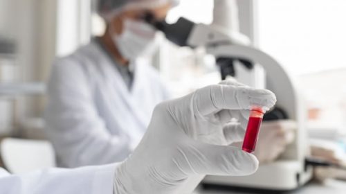 Bioquímicos alertan por costos triplicados y laboratorios con riesgo de cierre tras las “devastadoras” medidas económicas