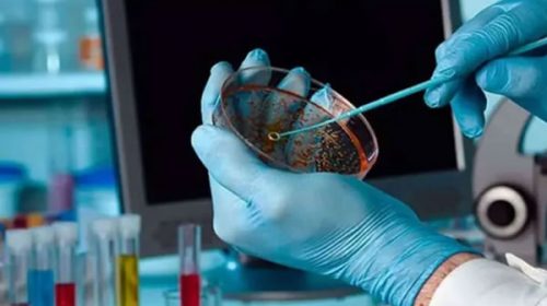 Investigadores del CONICET patentaron una nueva molécula para combatir el Parkinson