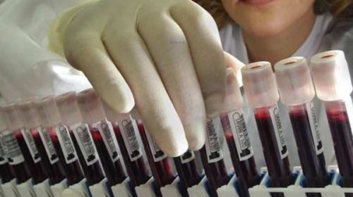 Reino Unido reconoció que infectó a miles de personas con sangre contaminada