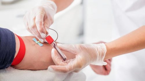 En junio, más de 170 personas donaron sangre en las distintas colectas externas