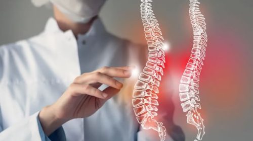 Producen el primer medicamento nacional para el tratamiento de la Atrofia Muscular Espinal