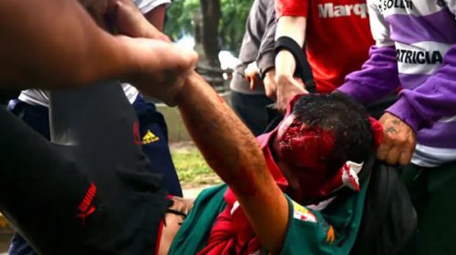 Francos minimizó el ataque al fotógrafo: “fue un accidente no previsto”