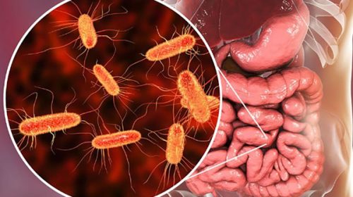En Argentina se registran unos 300 casos al año de Síndrome Urémico Hemolítico