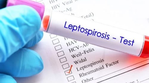 Entre Ríos ya registra 15 contagios en personas por leptospirosis en lo que va del año