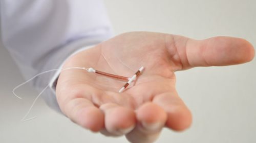 Se colocaron más de 3.000 anticonceptivos de larga duración en Entre Ríos y 348 fueron para adolescentes