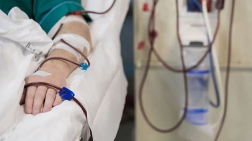 PAMI recortó los pagos para diálisis: los centros denuncian una brecha del 50% entre costos y cobertura
