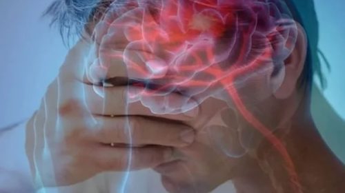 Salud remarcó la importancia de la detección precoz y la atención médica urgente frente a los síntomas de un ACV