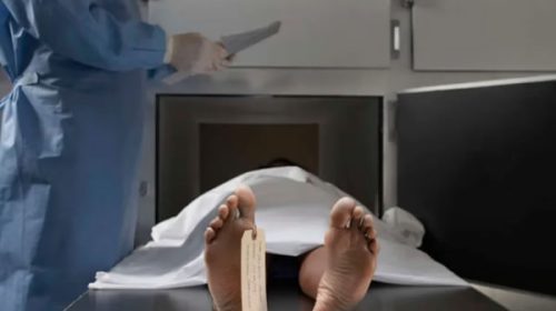 Por primera vez, realizaron una autopsia virtual en Argentina: cómo es el procedimiento Por primera vez, realizaron una autopsia virtual en Argentina: cómo es el procedimiento